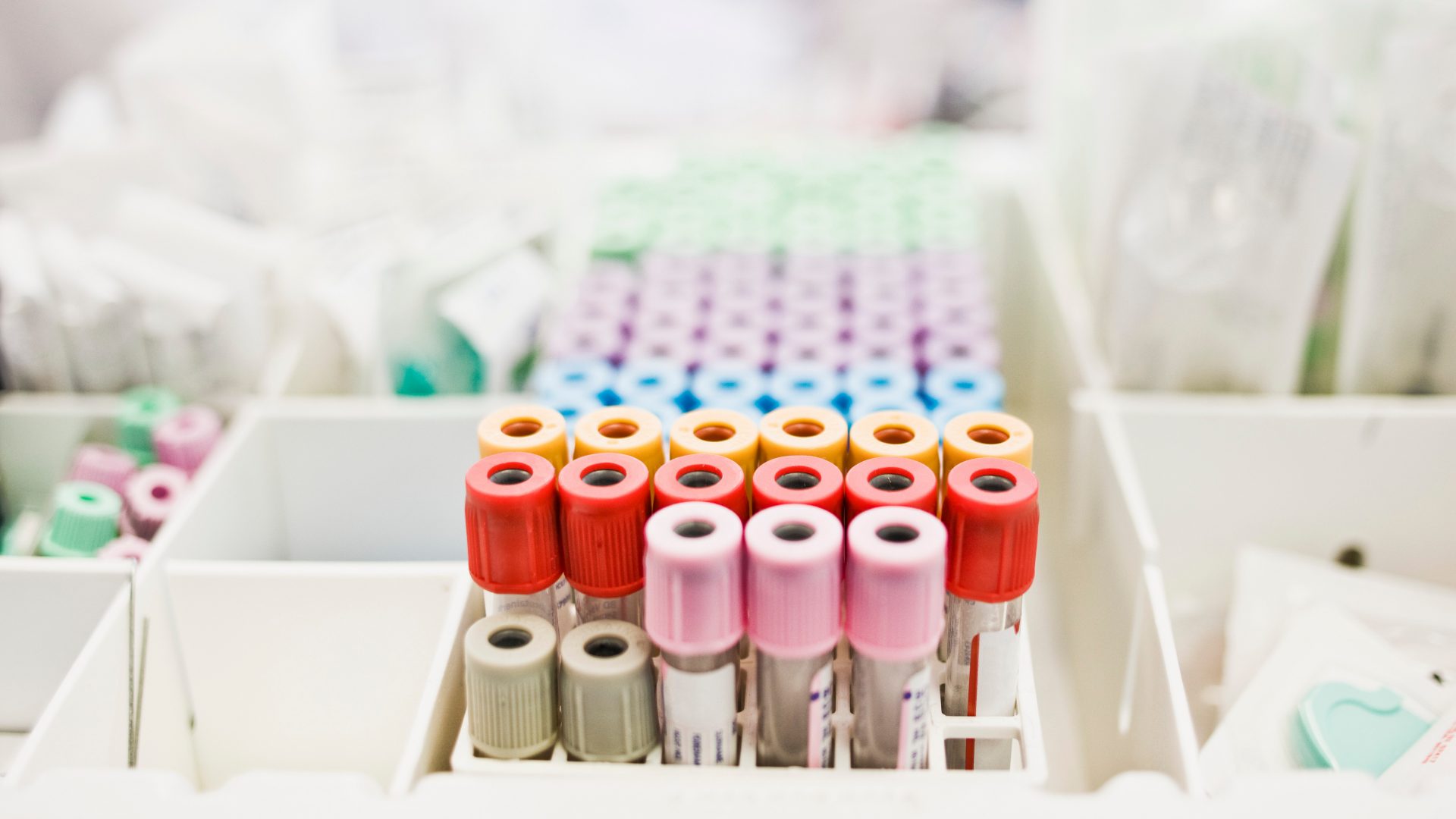 Das Bild zeigt eine Sammlung von Blutprobenröhrchen mit verschiedenfarbigen Verschlüssen, die in einem Labor organisiert sind. Diese Röhrchen werden typischerweise für Blutuntersuchungen und Labortests verwendet.